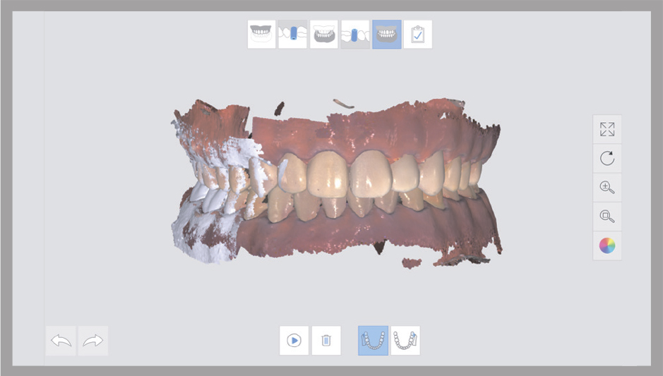 Meditscan11