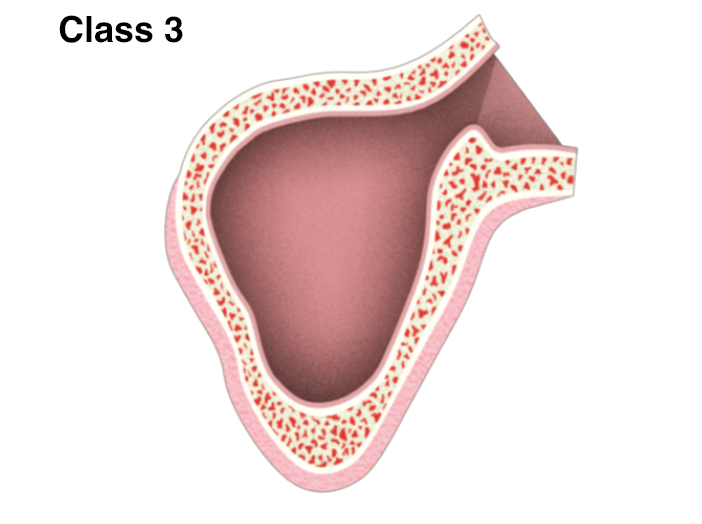 Sinus 33