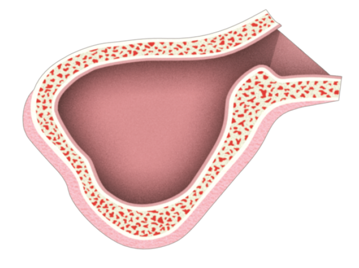 Sinus-1-