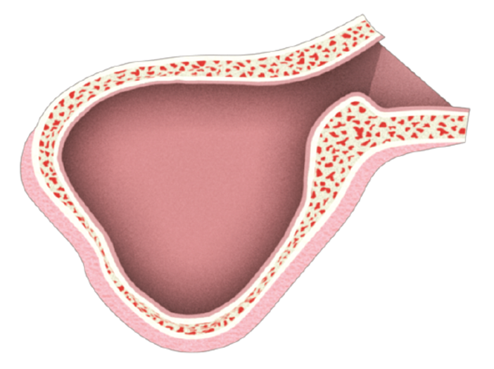 Sinus-2