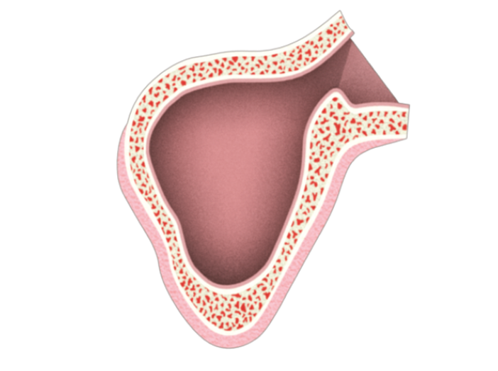 Sinus-3